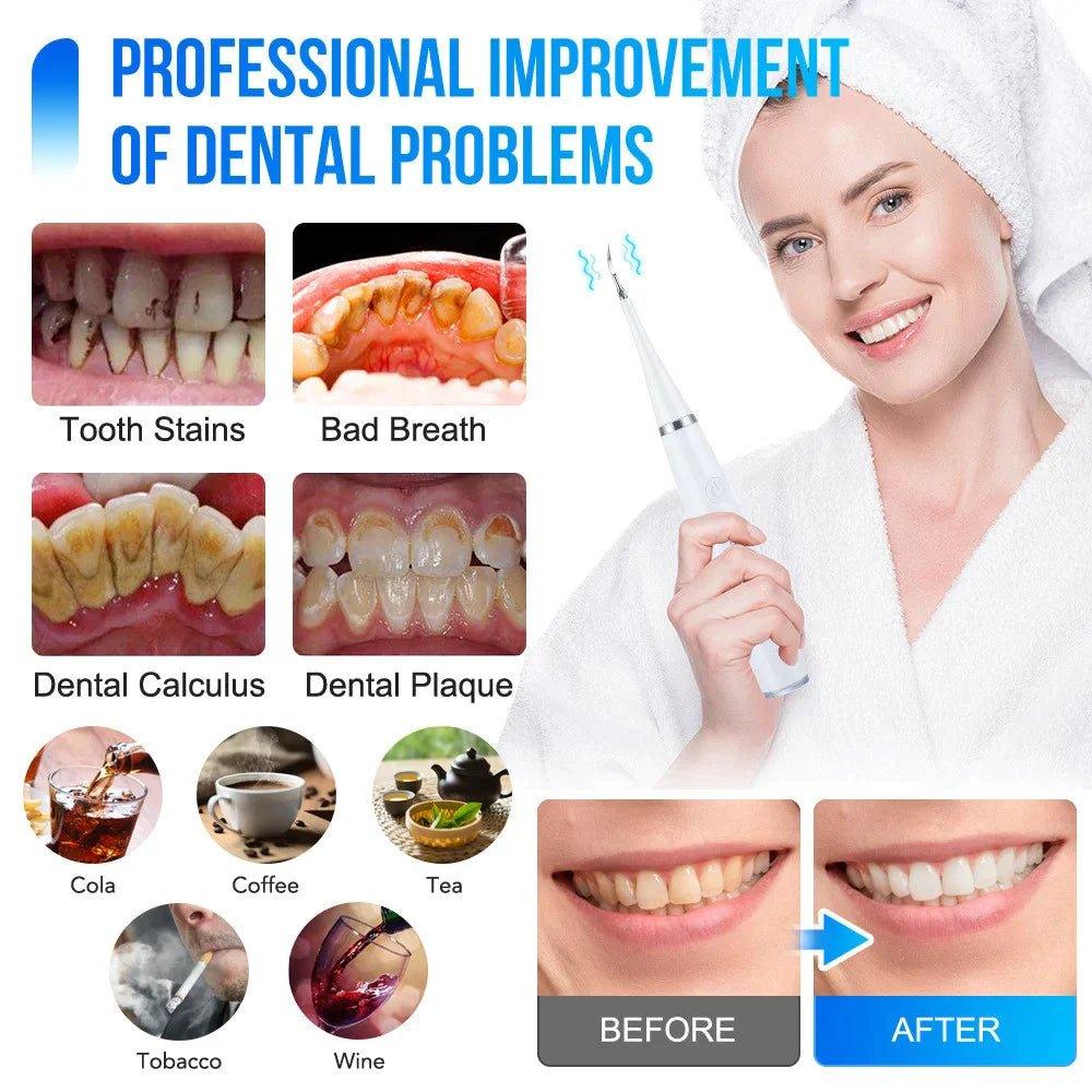Dental Cleaner™ | for professional-quality cleaning