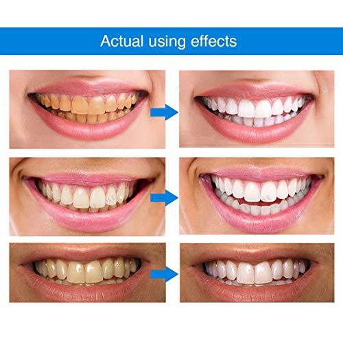 DentsBlancs™ | Feel confident when your smile reflects your radiance!