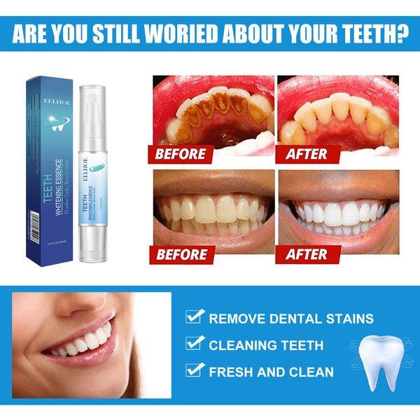 DentsBlancs™ | Feel confident when your smile reflects your radiance!