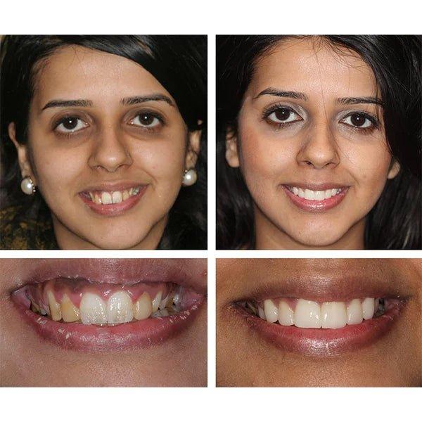 DentsBlancs™ | Feel confident when your smile reflects your radiance!