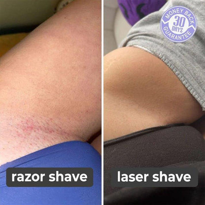 SmoothBeam™ - Painless Laser Hair Removal at Home for Body, Face, and Bikini Area
